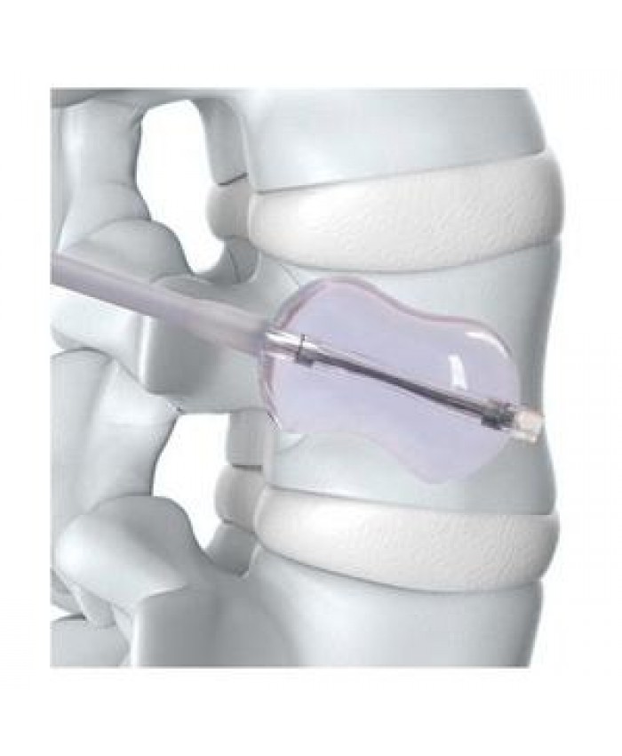 balloon kyphoplasty vertebroplasty balloons aguja aguj highquality kyphoplasty and vertebroplasty surgery kit tool